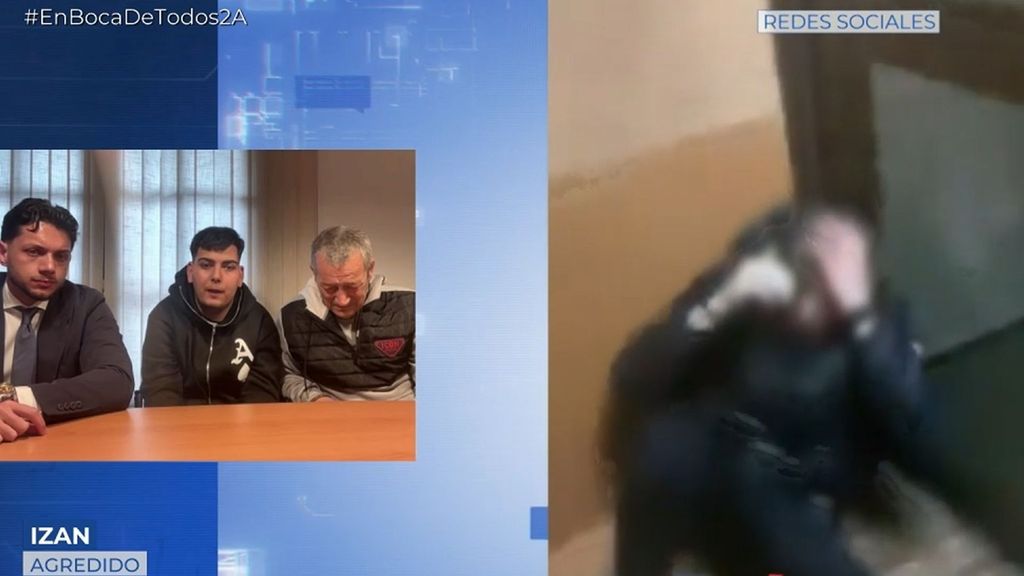 Izan, el joven con discapacidad que fue apaleado, tras la paliza a uno de sus agresores: ''No hay que tomarse la justicia por su mano''