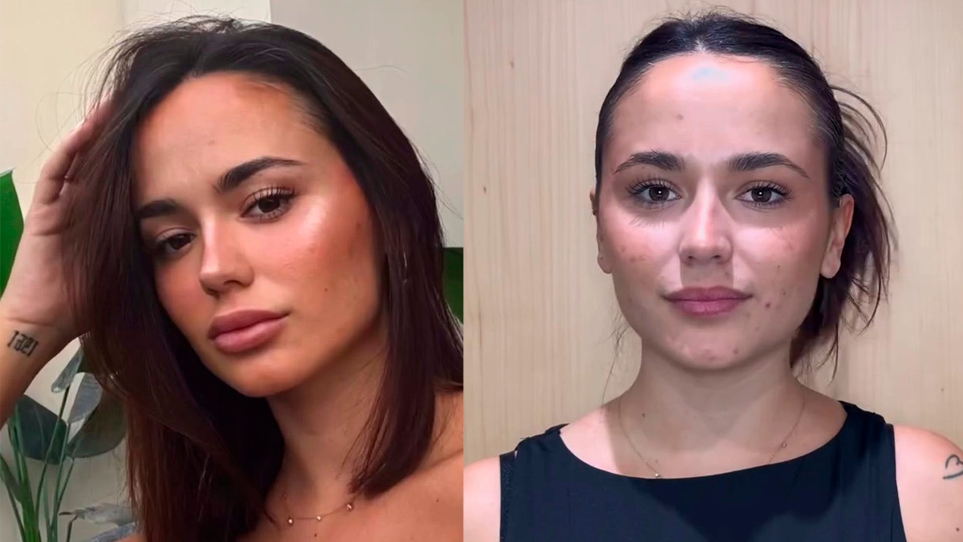 El antes y después de los labios de Gala