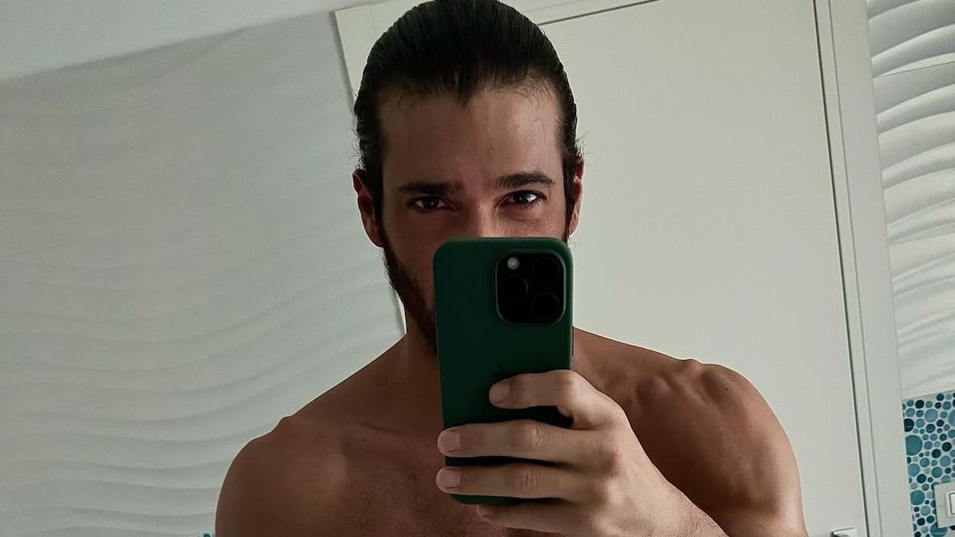 Así está Can Yaman tras adelgazar 10 kilos en un mes Así está Can Yaman tras adelgazar 10 kilos en un mes