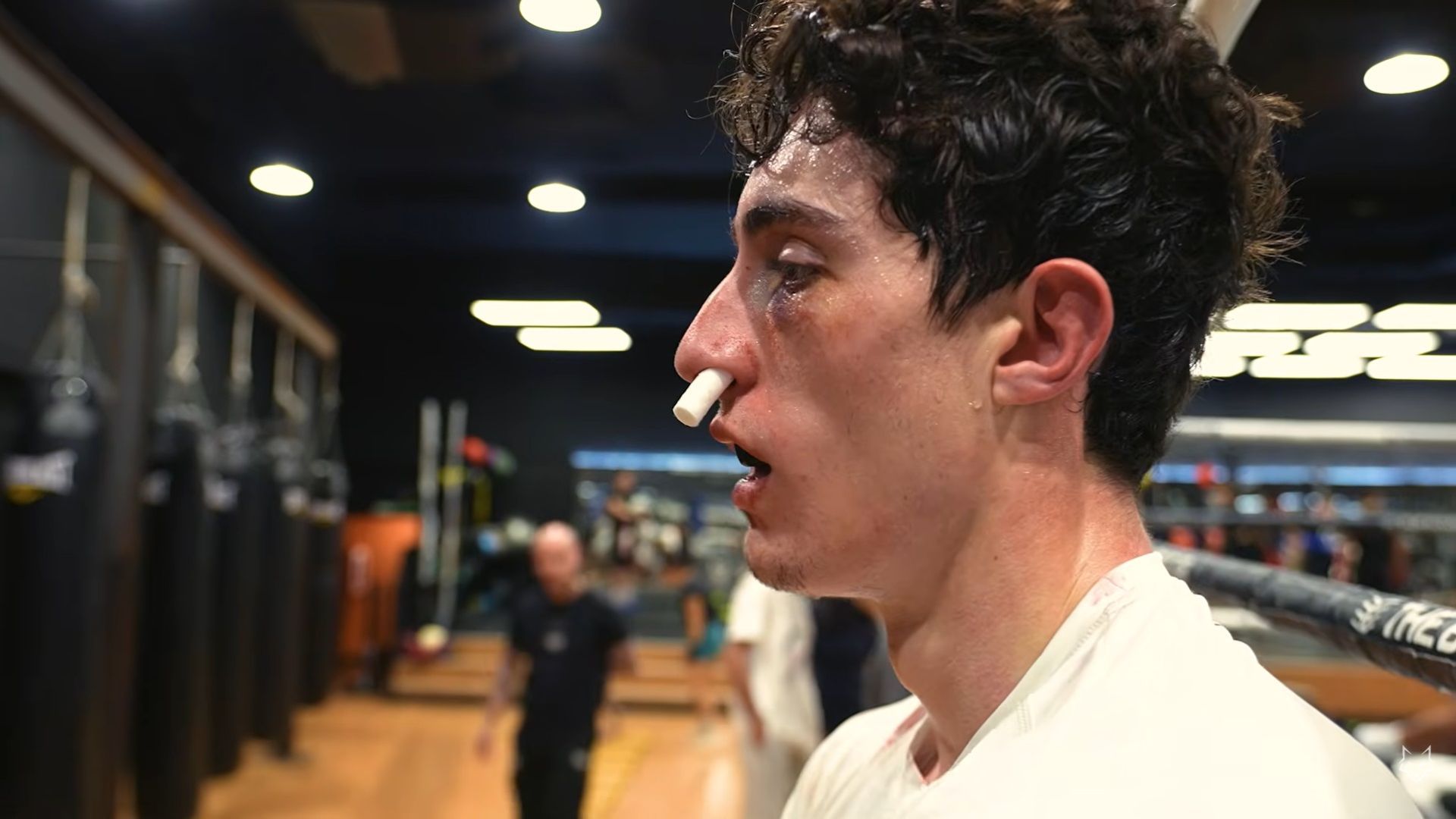 El complejo sparring de Plex le deja con un ojo morado tras pelear con Misho El complejo sparring de Plex le deja con un ojo morado tras pelear con Misho