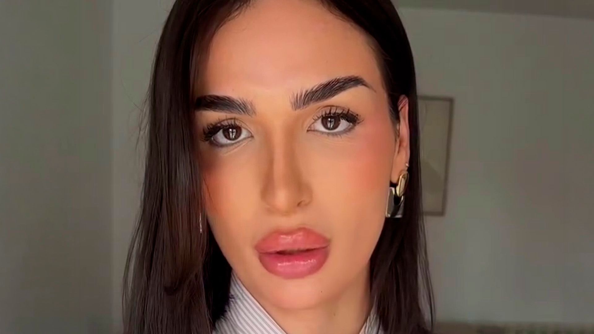 Keyla Suárez, de ‘LIDLT’ actualiza el estado de su calva tras ponerse en manos de profesionales