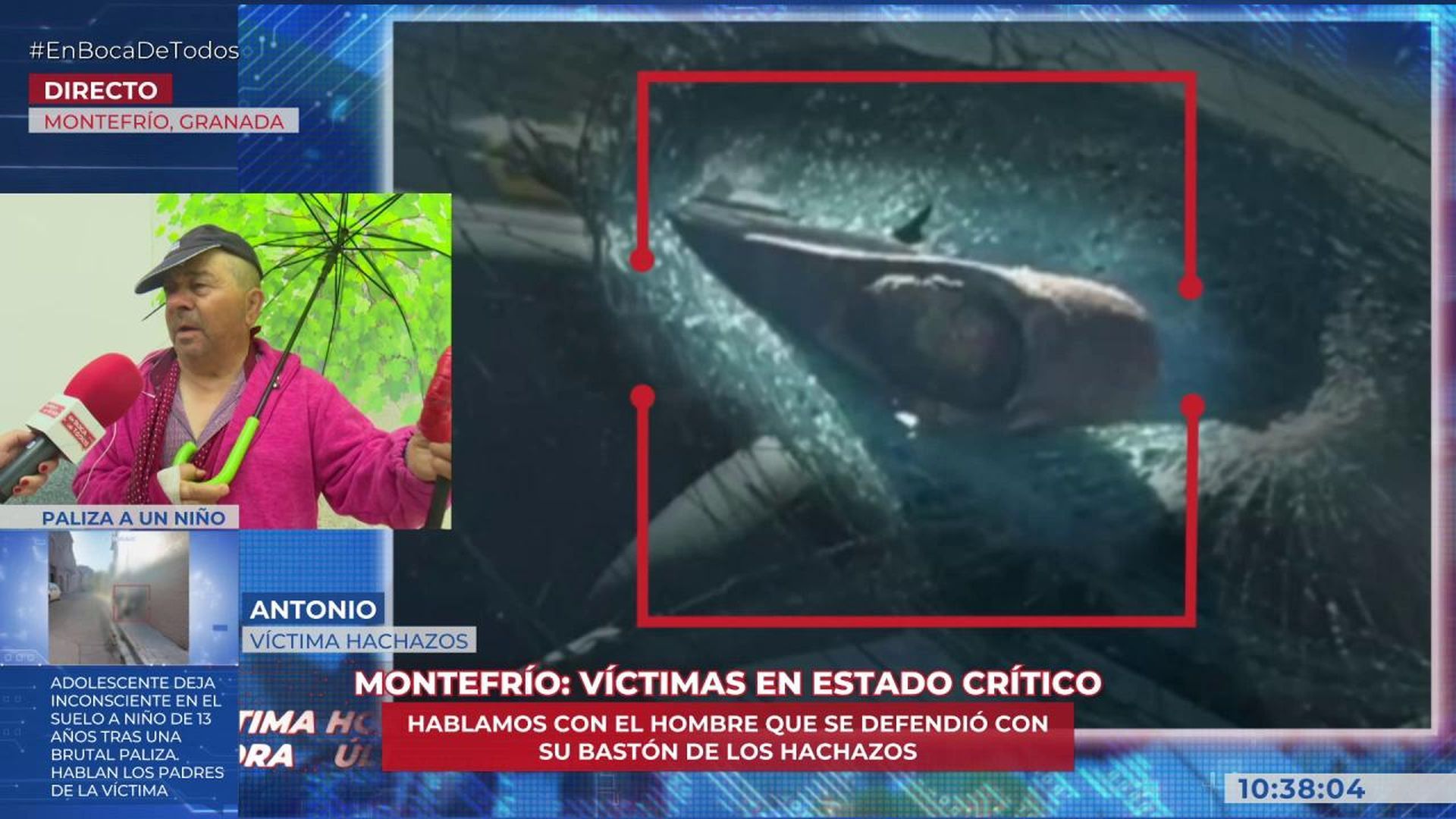 Antonio víctima de la agresión en Montefrío (Granada): “A la cabeza iban todos los hachazos”