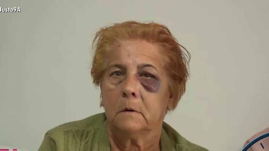 Carmen, una mujer de 68 años agredida con un puño americano por un vecino que acumula 70 denuncias en Almuñécar: "Me podría haber matado"