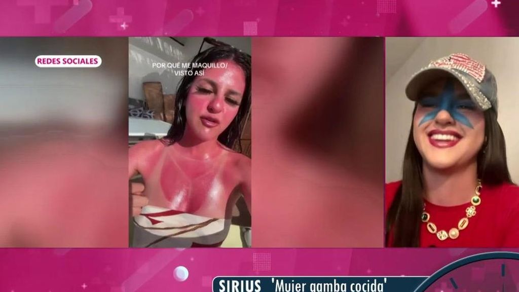 Sirius, una mujer que se maquilla simulando el 'efecto gamba' del sol: "Tenía amigos diciéndome que me fuese a urgencias corriendo"