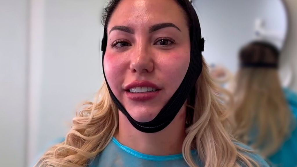 Steisy acude a una clínica estética para someterse a un endolift facial