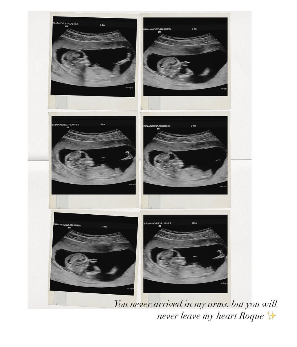 María Fernández-Rubíes comunica la pérdida de su bebé