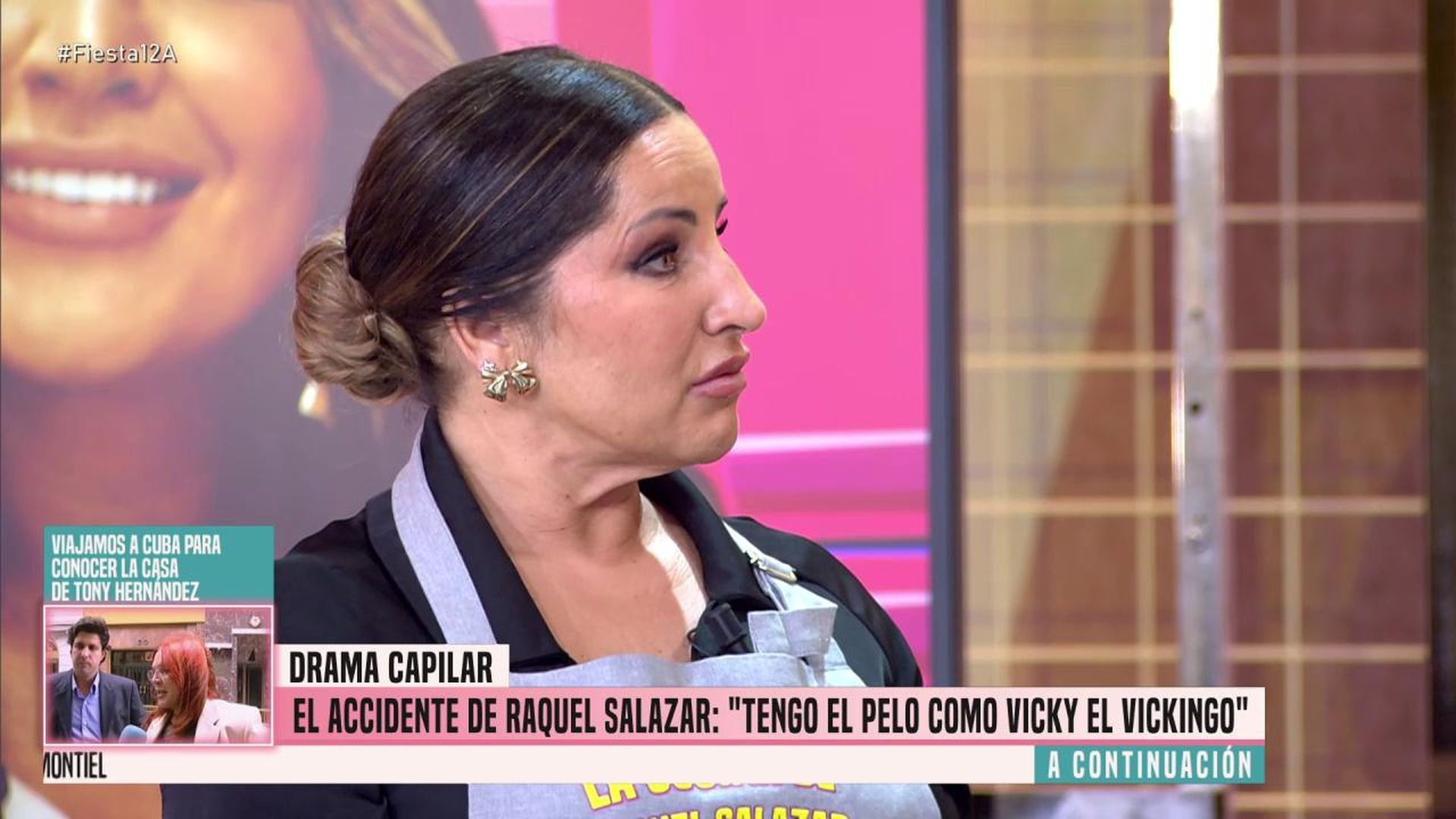 Raquel Salazar habla en 'Fiesta' de su drama capilar