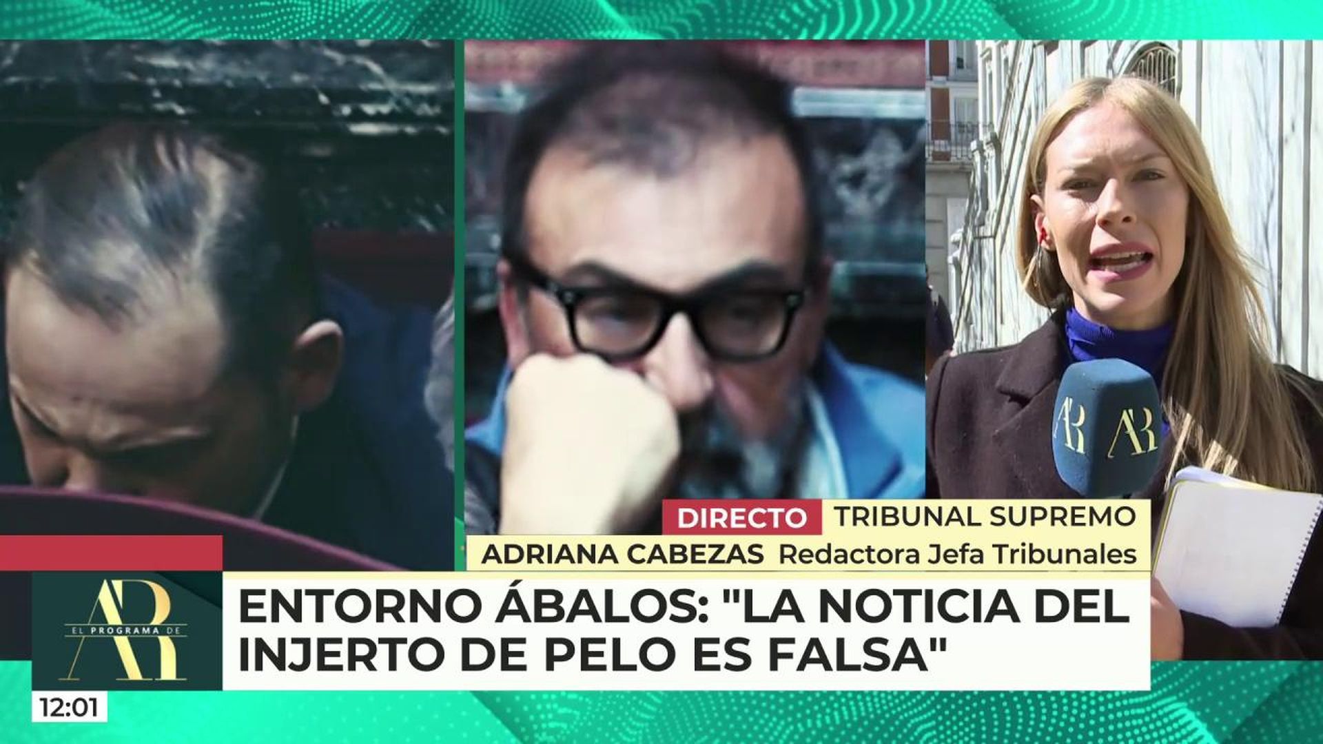 El entorno de Ábalos desmiente que el hermano de Antonio Anglés le hiciese un injerto de pelo