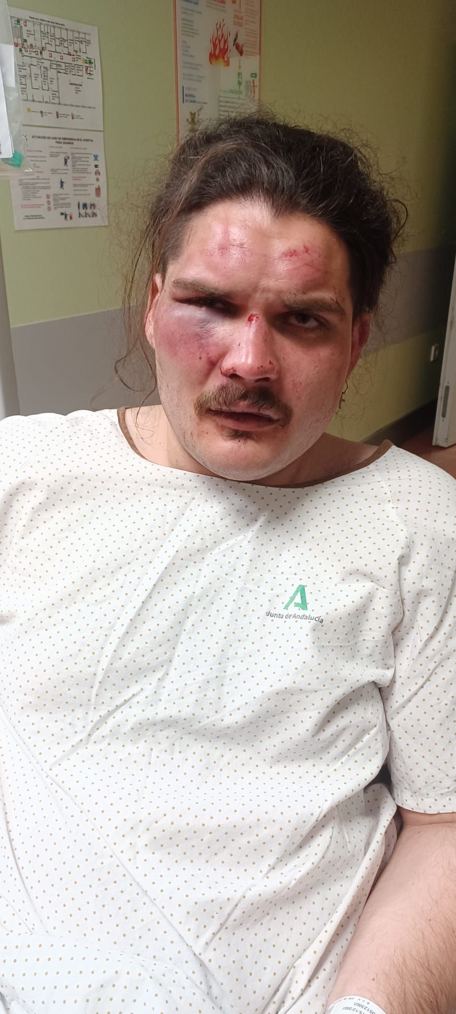 Imagen de Roberto tras la agresión