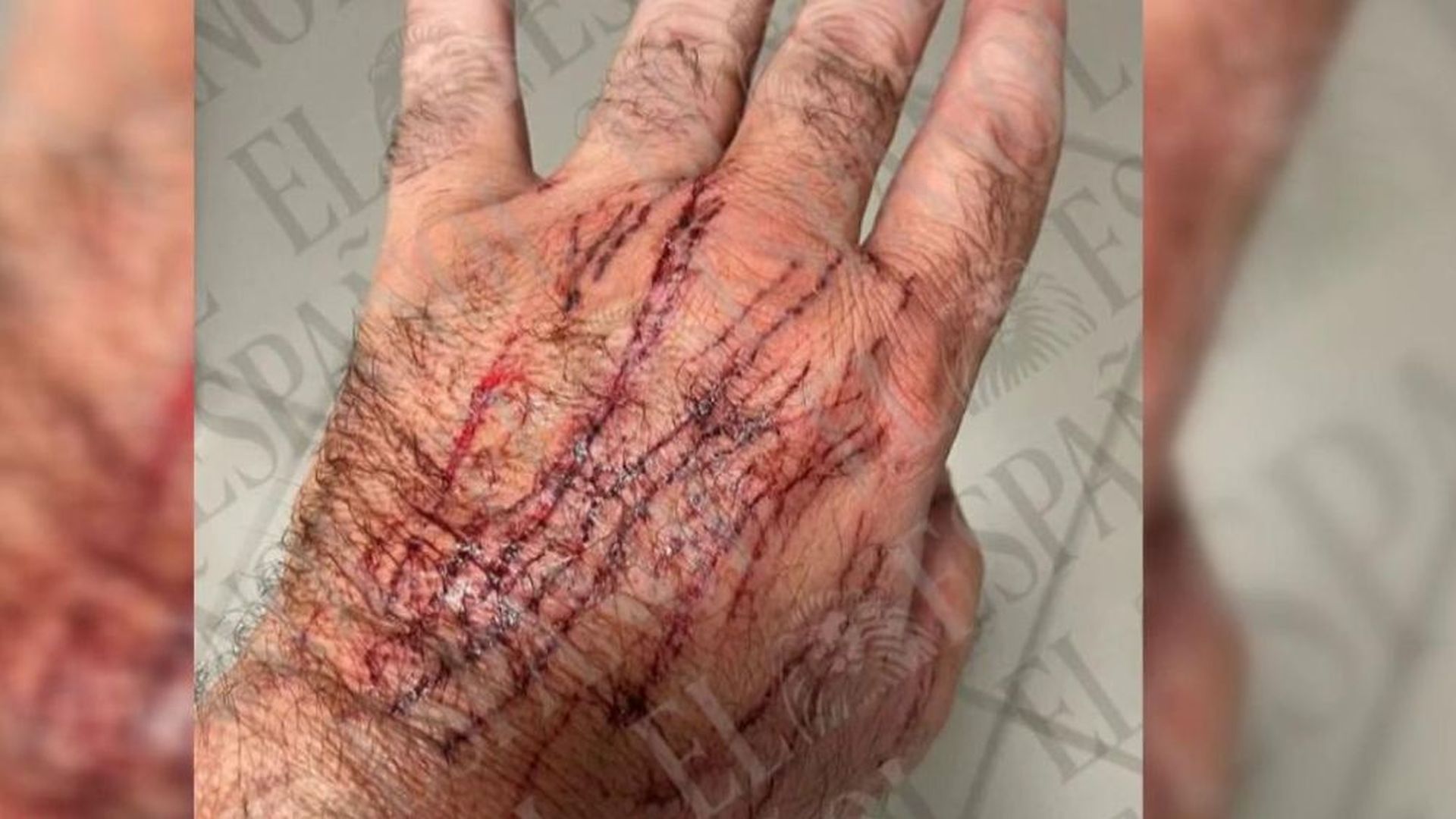 La gata de la discordia entre Ábalos y su ex atacó a Koldo