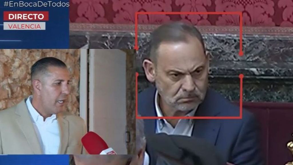 El hermano de Antonio Anglés le hizo un injerto de pelo a Ábalos y a Koldo: "Cerré la clínica para ellos y no cobré nada"