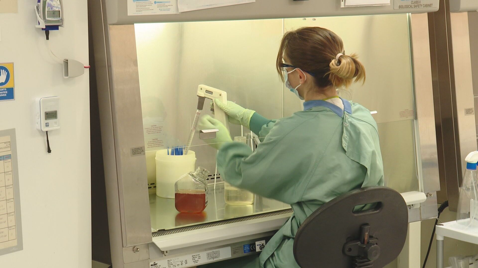 Un hombre de 62 años, la décima persona del mundo curada de VIH con células madre