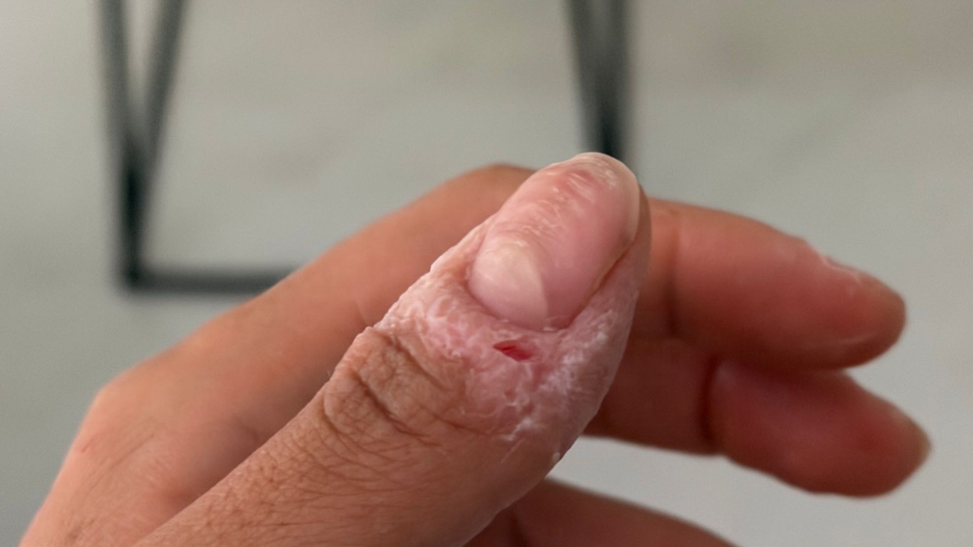 Así tiene los pulgares Sofía Suescun