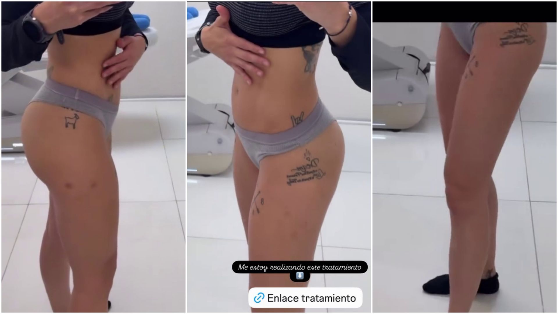 Sheila Casas muestra los primeros resultados del tratamiento de remodelación 360 que se está haciendo