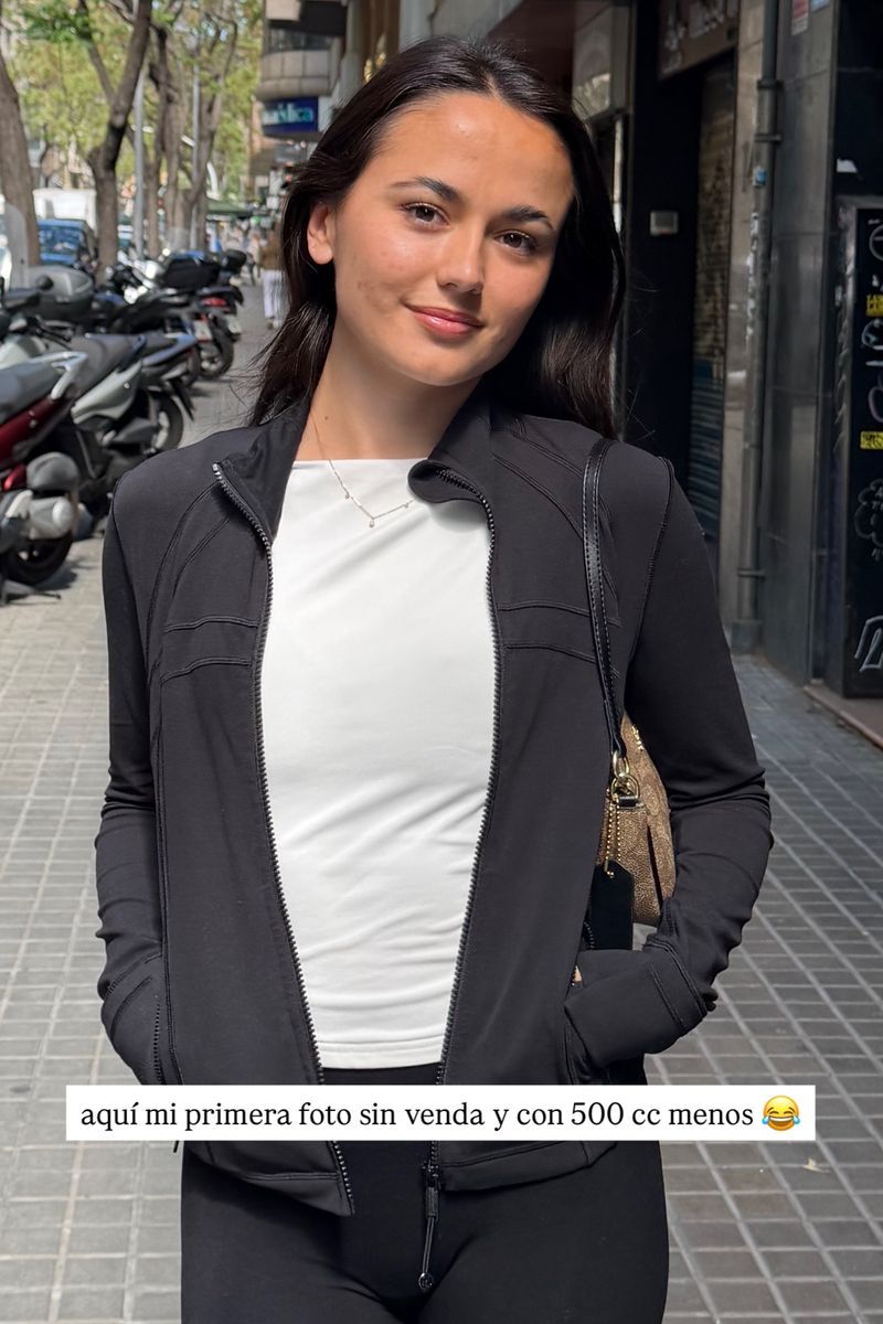 La primera foto de Gal·la sin prótesis