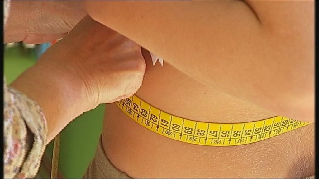 Los niños obesos vivirán menos años que sus abuelos