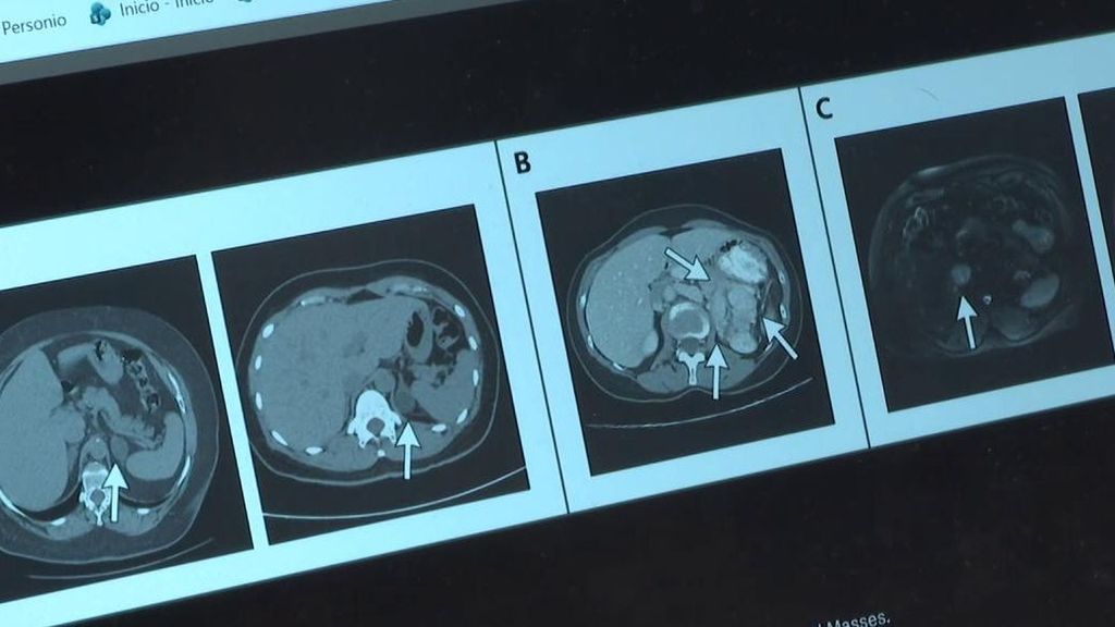 Casi un 28% de médicos consultan a diario el chat de Open AI, pero aún se ven insustituibles