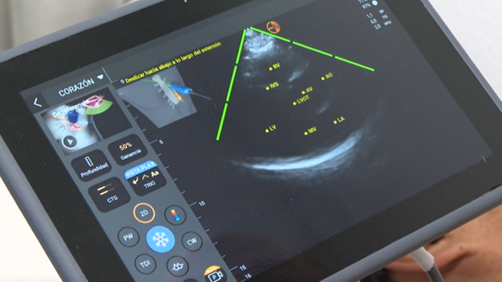 Los casos "concretos" en los que los médicos usan IA con sus pacientes: "No podemos usarla en todo, ahí se equivocan"