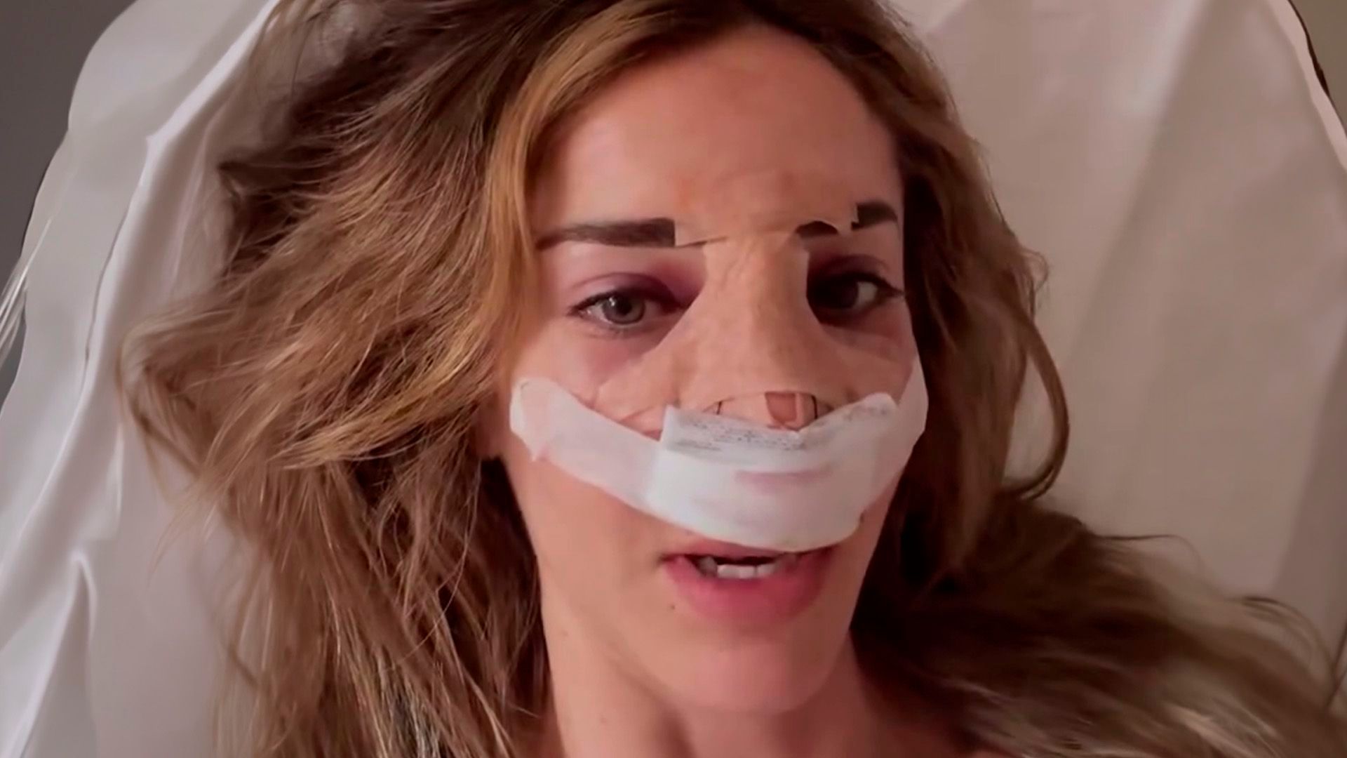 Nieves Bolós, de 'Supervivientes', pasa por quirófano