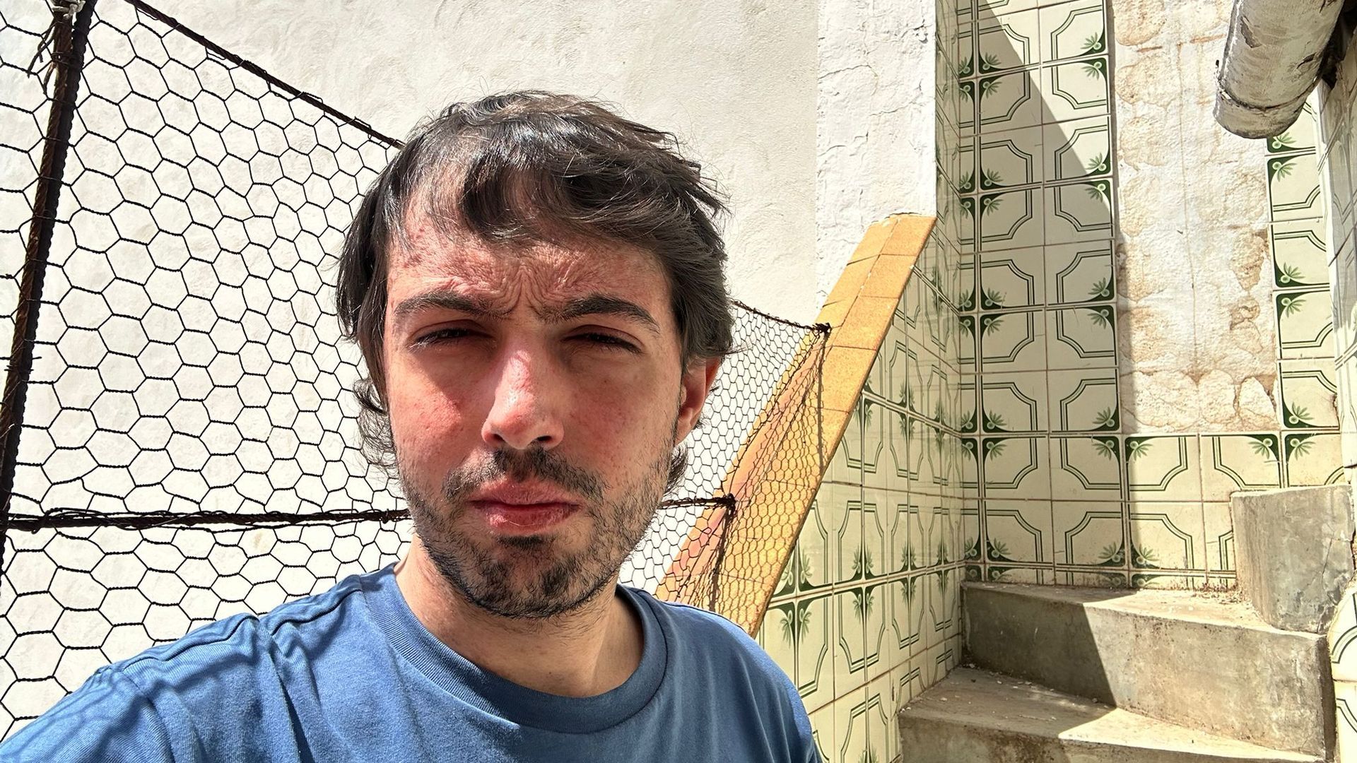 Rubén ha superado la leucemia aunque todavía sufre efectos secundarios