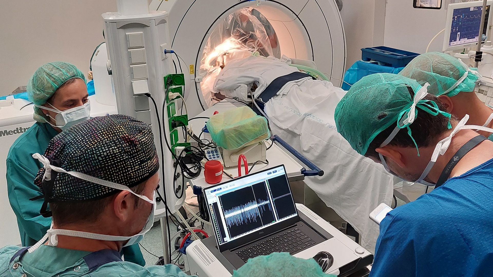 Se colocan dos electrodos en una zona específica del cerebro