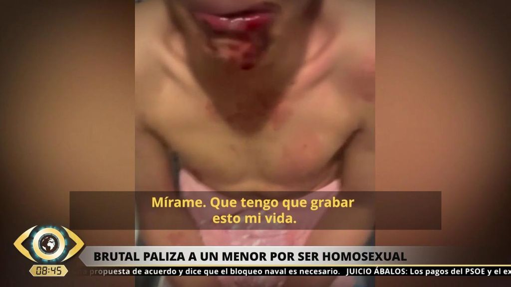Brutal agresión homófoba a un menor en Sevilla: "Solo quiero ser feliz como soy"