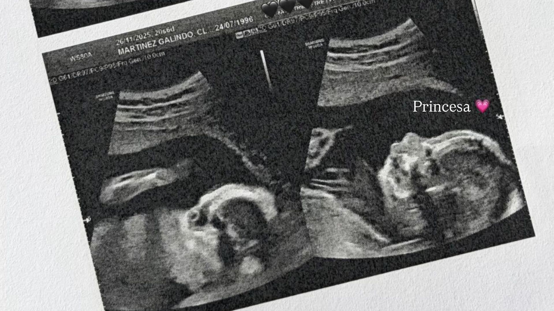 La ecografía de la semana 20 de la hija de Claudia y Mario