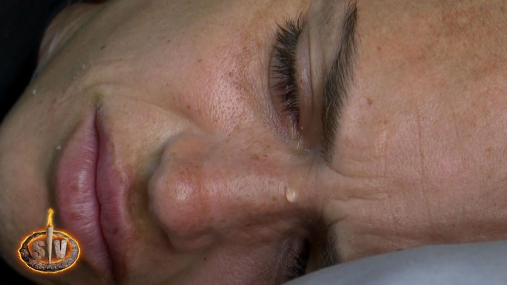 El momento en el que Almudena Porras ha tenido que ser atendida en la playa por el equipo médico de 'Supervivientes': "Duele mucho"