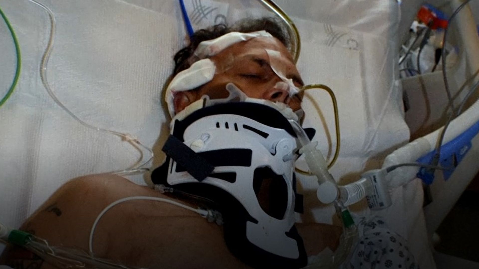 Así fueron los primeros intentos de asesinato a Sally Zottola, miembro de la mafia de NY