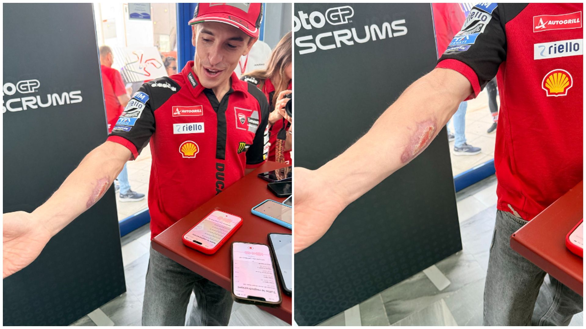 Marc Márquez y su brazo dolorido en Jerez