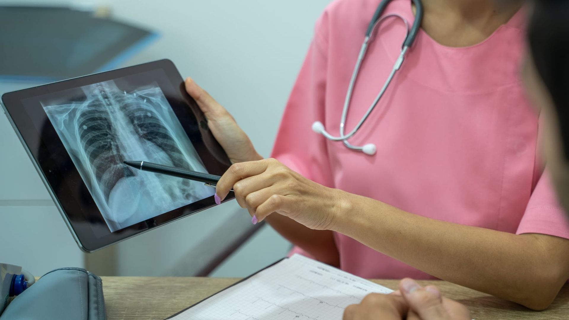 Tuberculosis