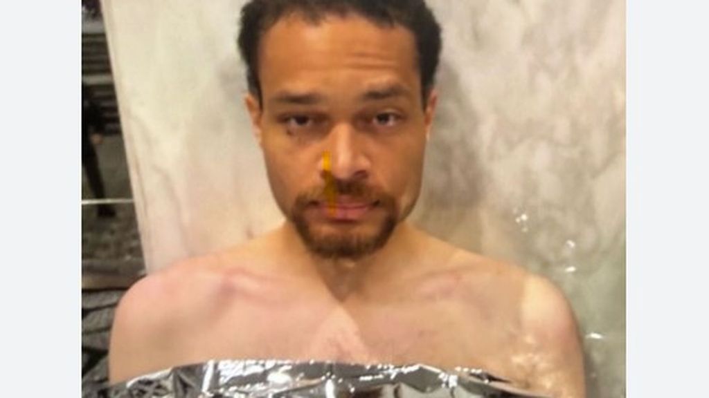 Los investigadores buscan en la casa de Cole Allen pistas que indiquen por qué atentó contra Donald Trump