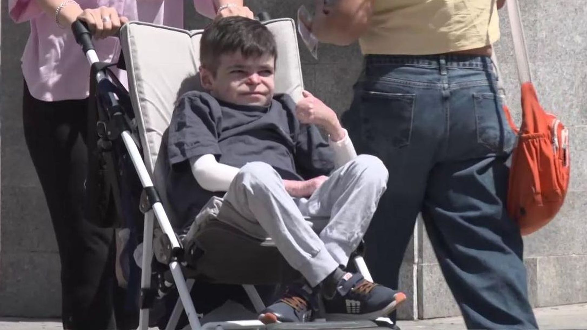 Leo recibe el tratamiento para su piel de mariposa, tras doce años de lucha: "Que se me cierre la herida y me de el aire fresquito"