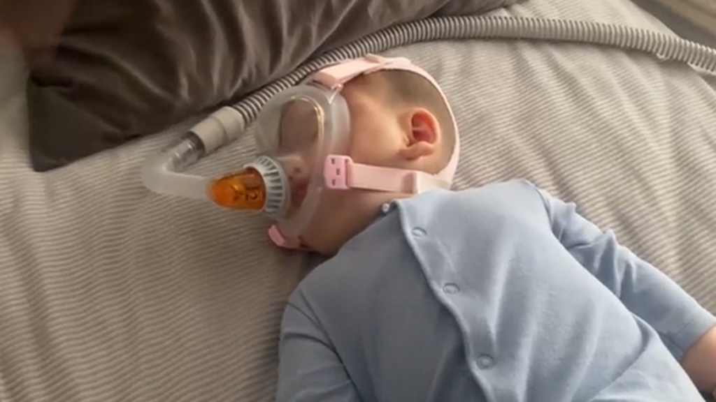 Thiago, con síndrome de Ondine, cuyo cerebro se olvida de respirar y necesita una máquina para sobrevivir mientras duerme: "No nota la asfixia"