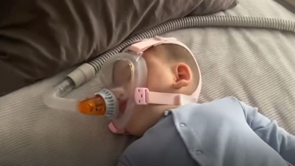 Thiago, el pequeño con el síndrome de Ondine, cuyo cerebro se olvida de respirar y necesita una máquina: "El miedo es escuchar la alarma y no despertarse"