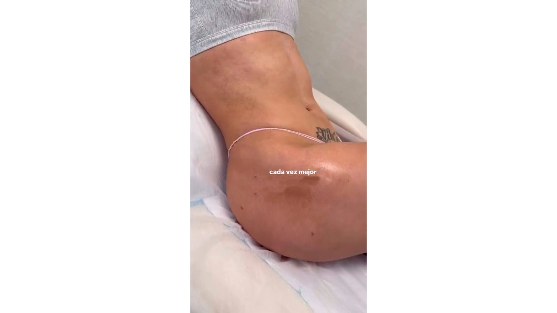 El resultado del abdomen de Ivana tras su remodelación corporal