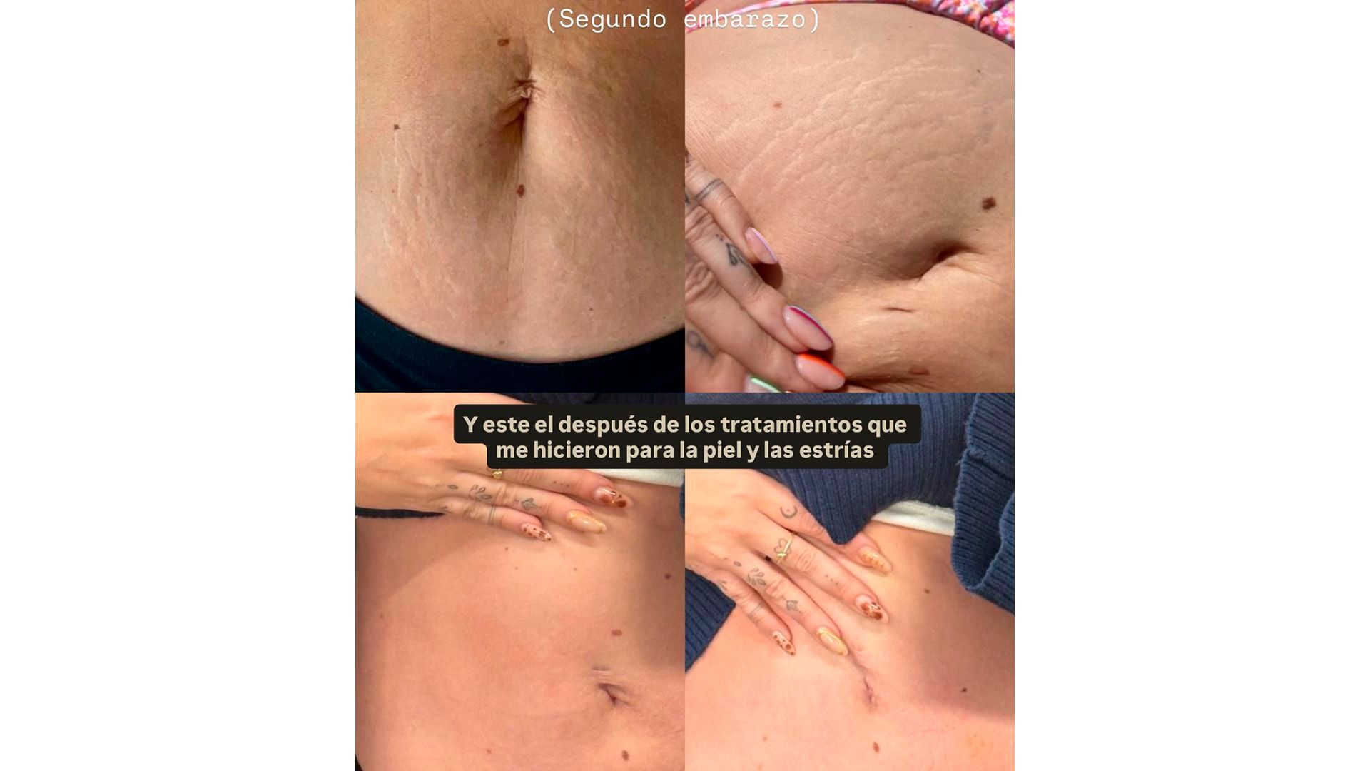 Danna Ponce enseña las estrías que le quedaron después del embarazo de Máximo