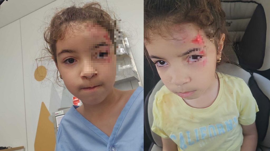 Las heridas de Lina, una niña con discapacidad de Castellón, a la que robaron su silla eléctrica: se ha caído en el colegio