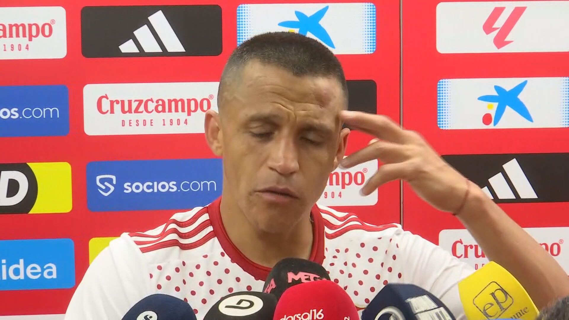 Alexis Sánchez y su chichón