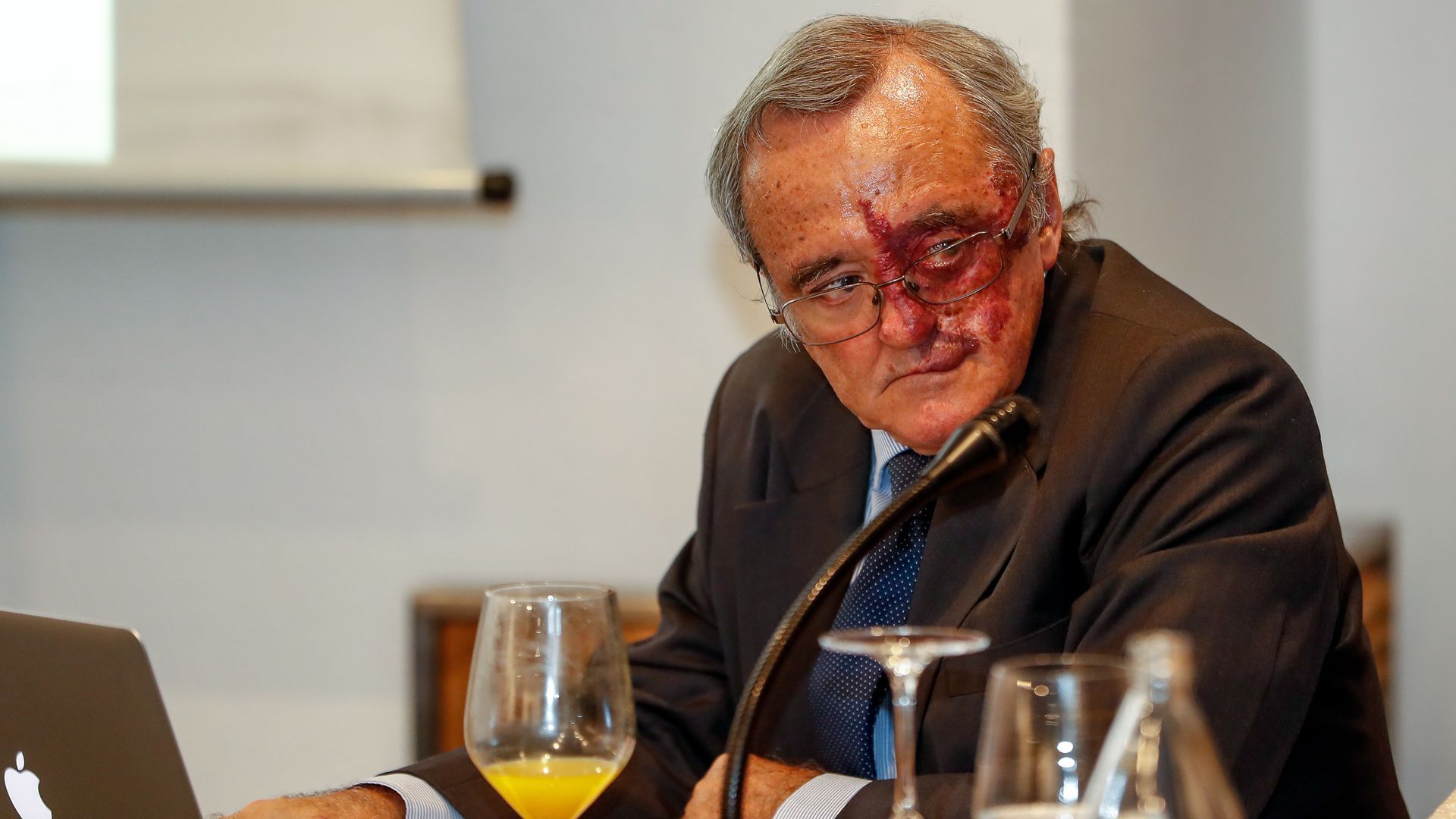 Mariano Barbacid renuncia a beneficiarse económicamente de su estudio del cáncer de páncreas: se desvincula de la empresa y las patentes creadas