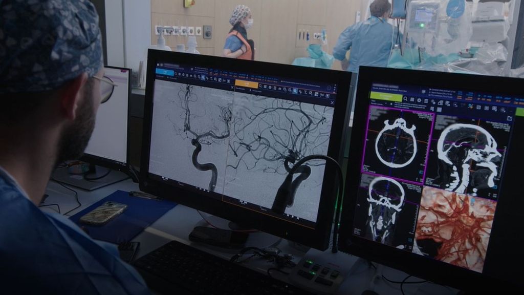 Una combinación de tratamientos mejora la recuperación tras un ictus grave