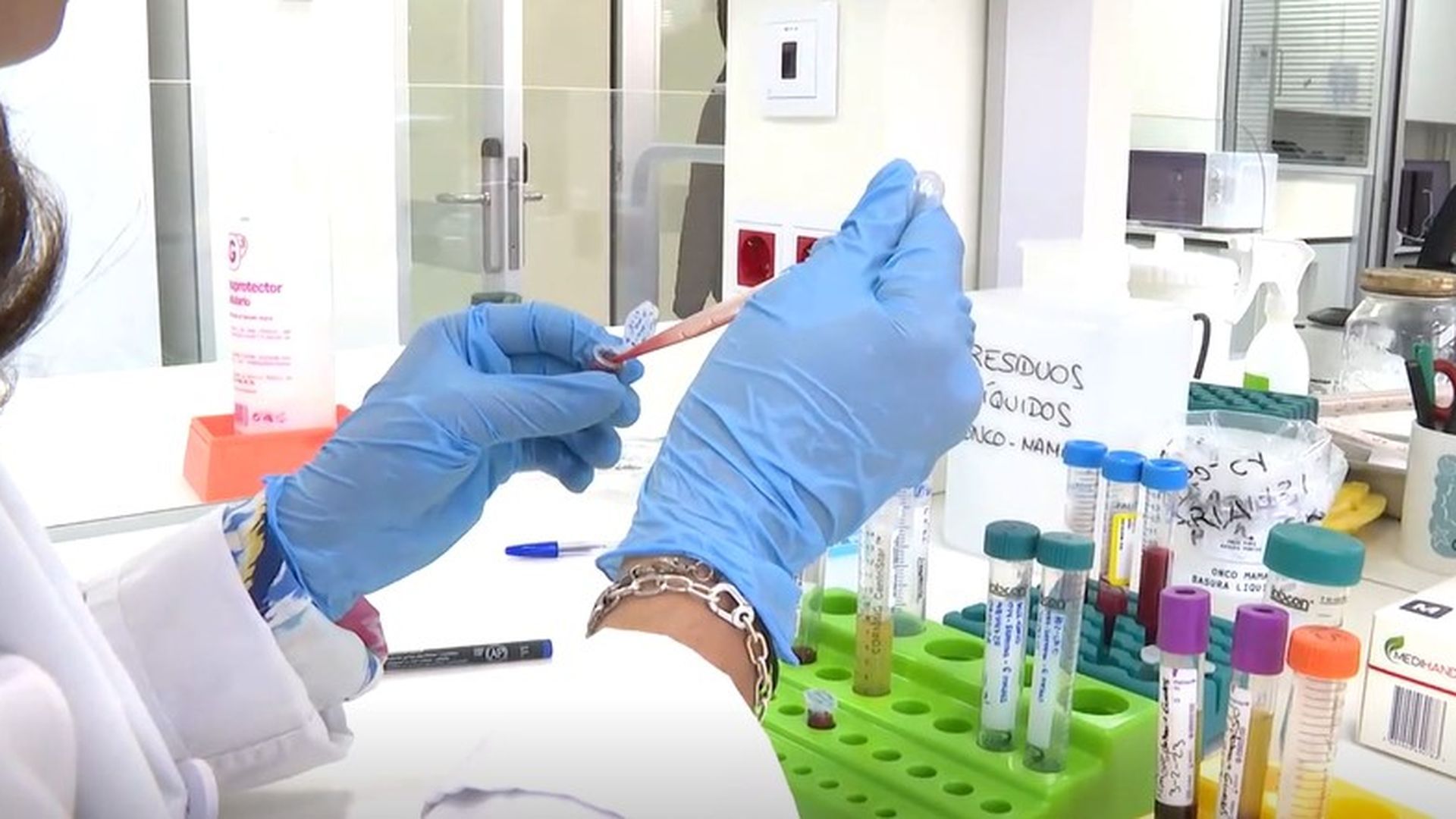 Las pruebas para detectar el hantavirus: basta un análisis de sangre donde se busca material genético del virus en el paciente
