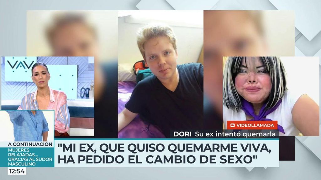 Víctima de violencia machista denuncia que su agresor solicite una cárcel de mujeres: "Él se reía mientras el fuego me arrancaba la piel"