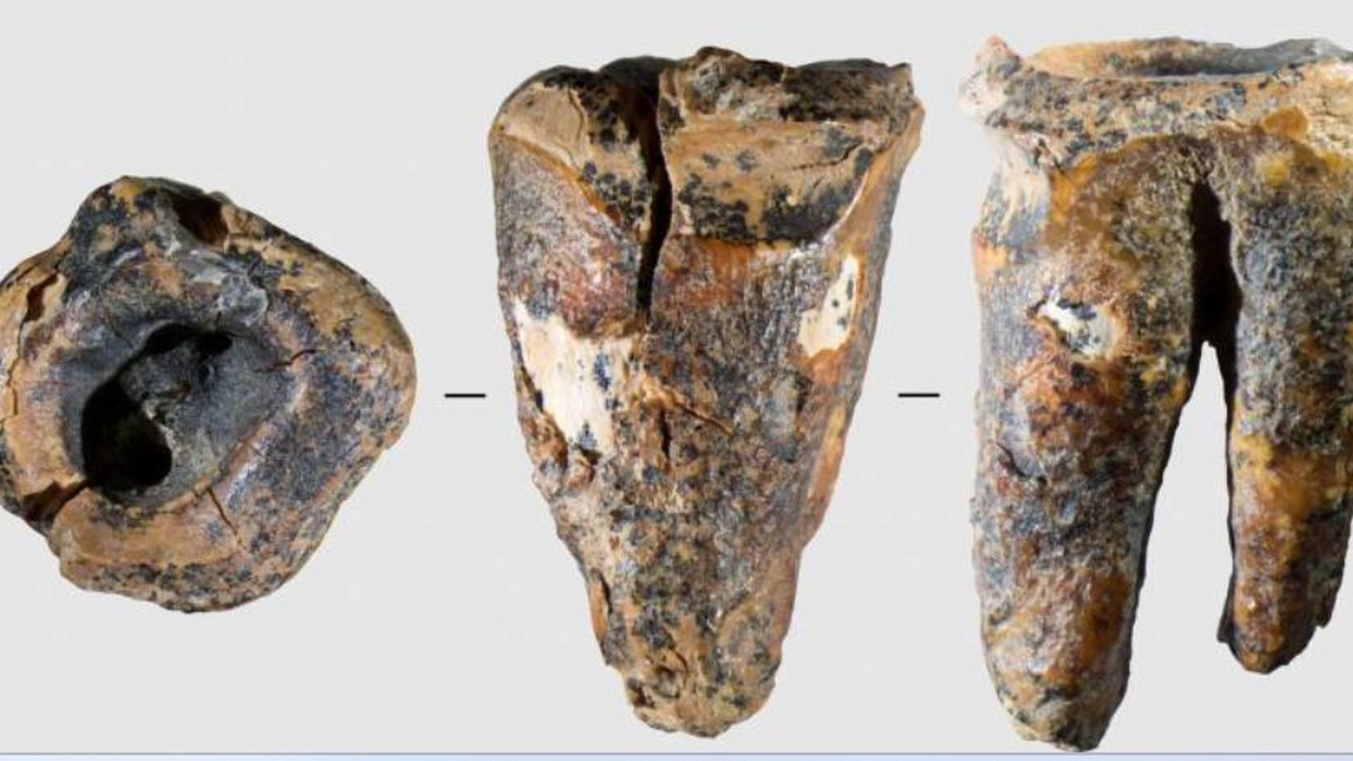 El diente de hace 60.000 años que desvela al primer dentista El diente de hace 60.000 años que desvela al primer dentista