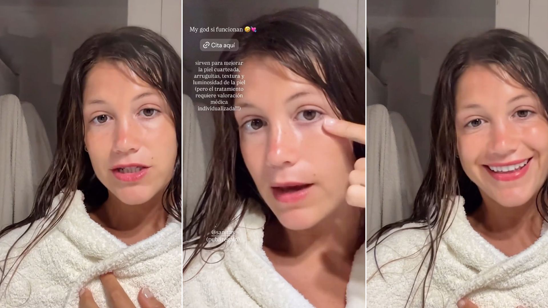 Miri Pérez-Cabrero muestra cómo está su piel tras el tratamiento