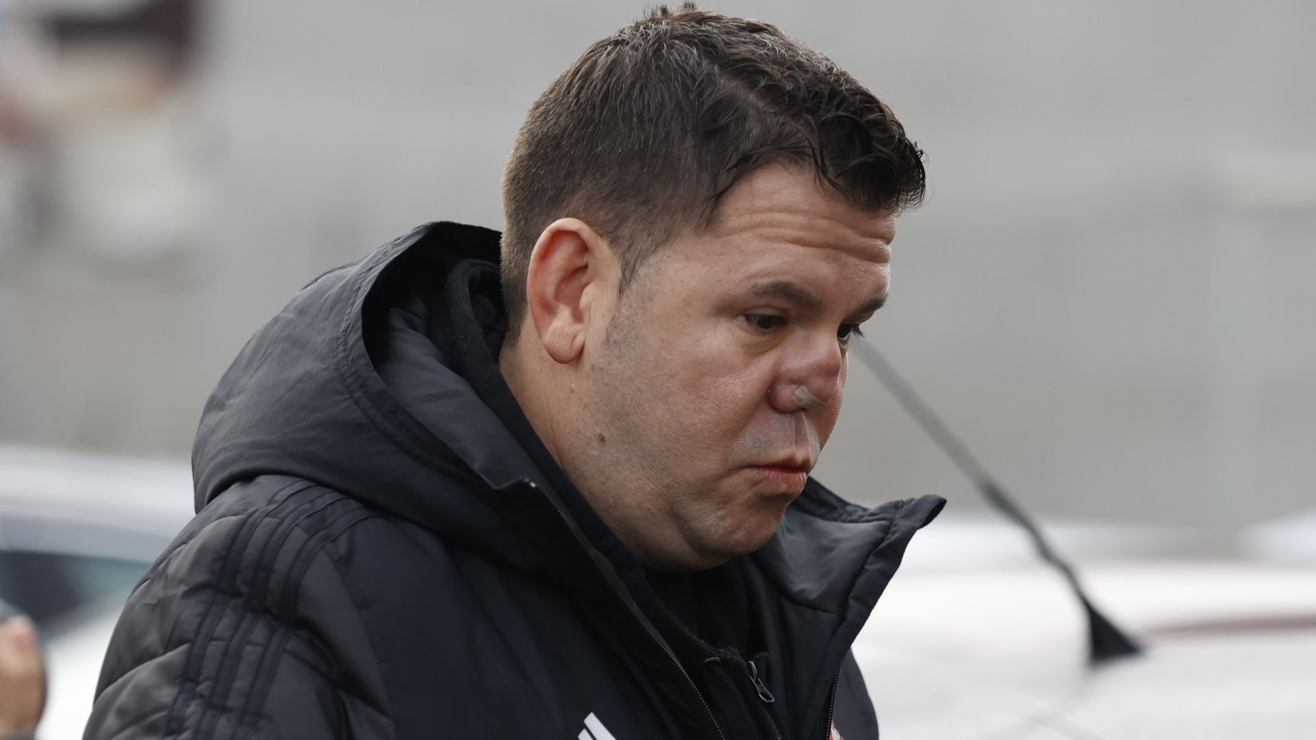 Lucas, de Andy y Lucas, ya conoce la fecha de su inminente operación de nariz Lucas, de Andy y Lucas, ya conoce la fecha de su inminente operación de nariz