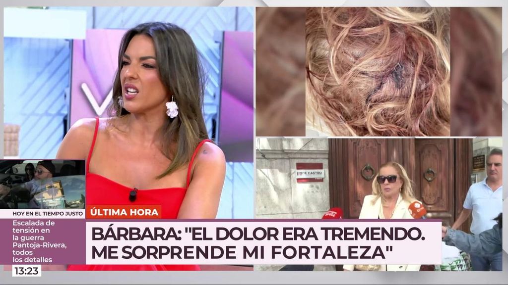 Bárbara Rey sufre un grave accidente: “Me pusieron siete grapas y el dolor era tremendo"