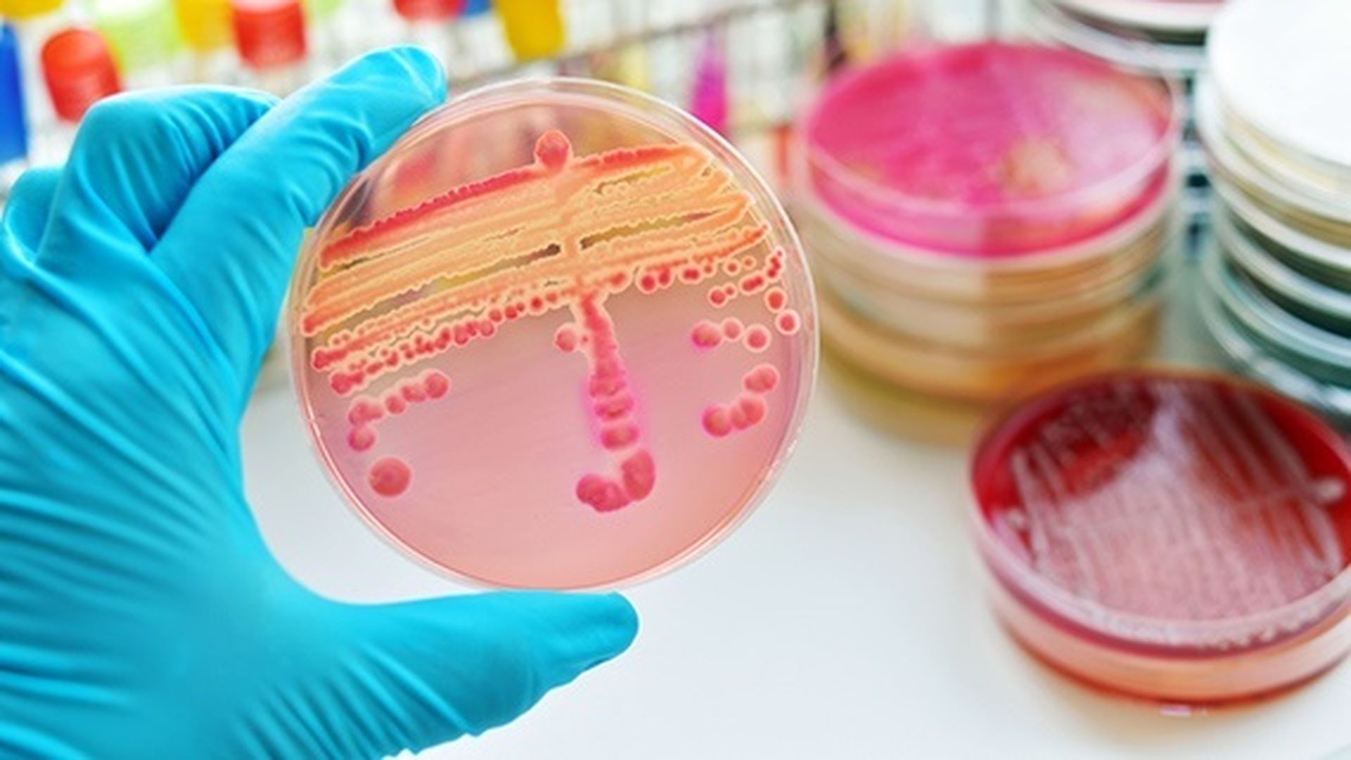 Microbiología