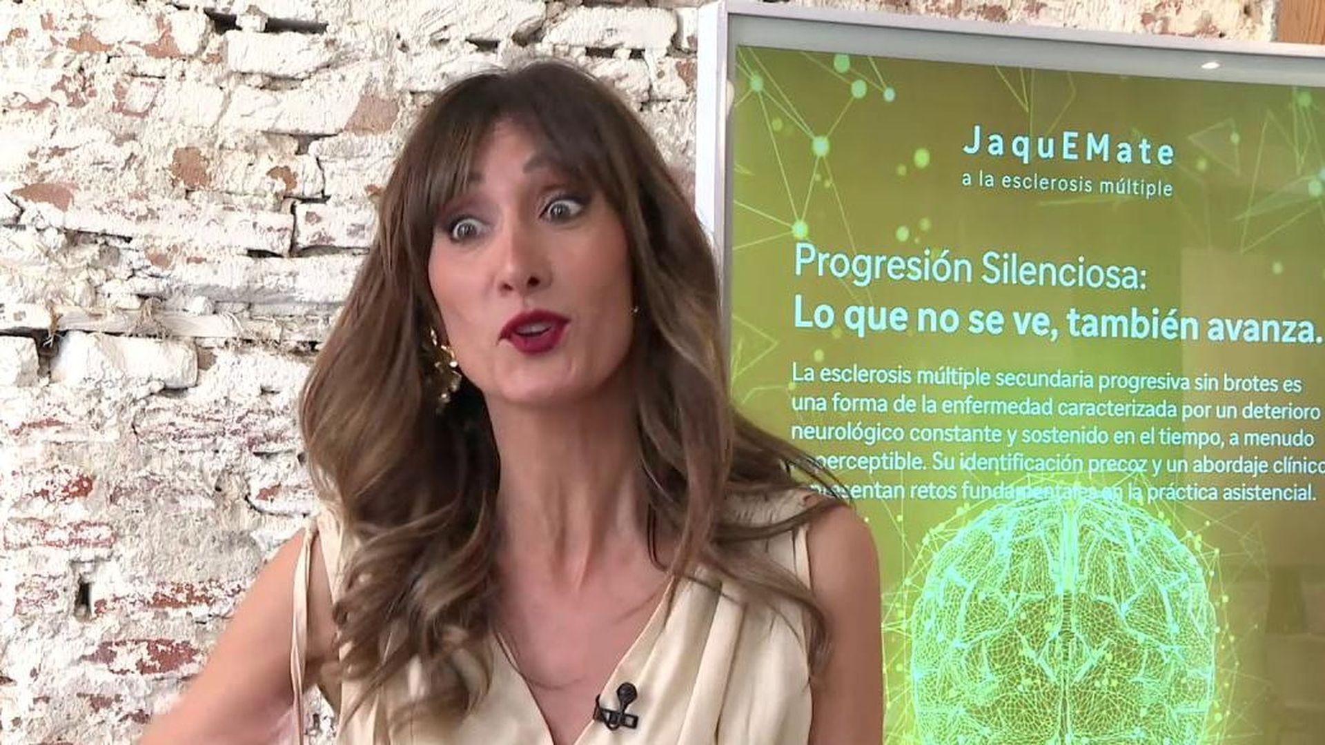 Cristina sufrió su primer brote de esclerosis a los 15 años: "Hasta los 33 no tuve diagnóstico"