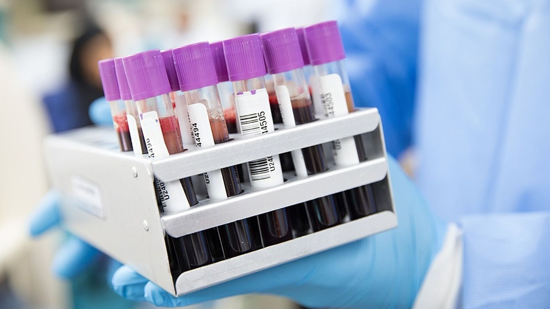 Un análisis de sangre Un análisis de sangre